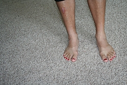 SBRT at  LOTO ?-ropers-feet.jpg