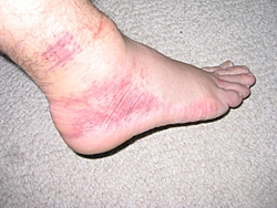 I think I sprained my ankle...Opinions???-img_0458.jpg