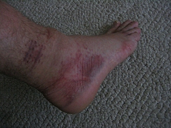 I think I sprained my ankle...Opinions???-img_0459.jpg